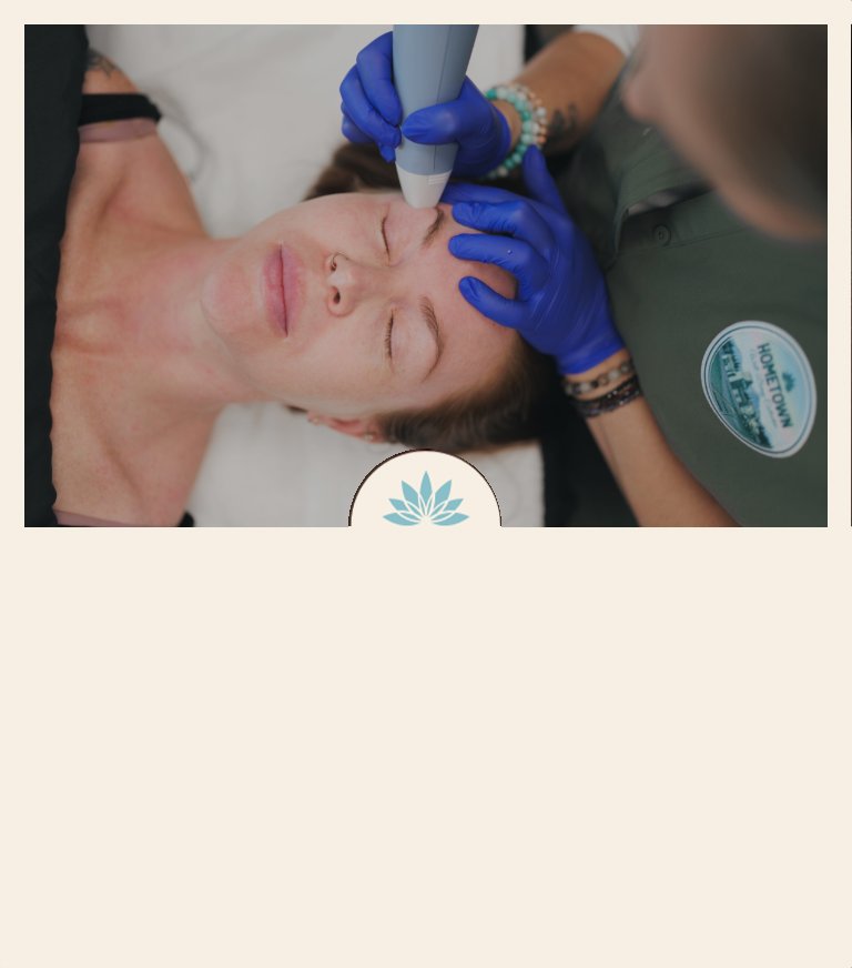 Microneedling and Resurfacing at Hometown Well-Being Collective in Okotoks